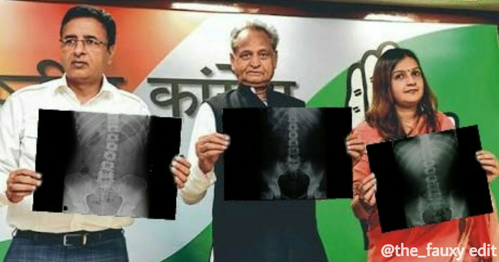 Congress Leaders Share X-Ray Reports Following Modi’s Claims That Demonetisation Broke The Backbone Of Corruption.