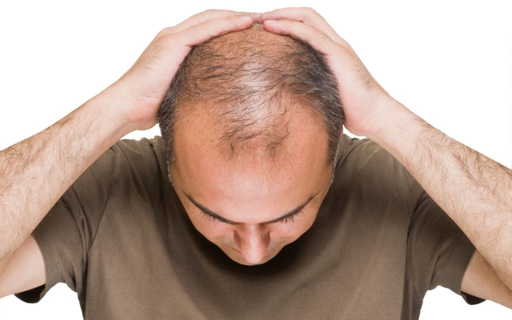 Hair fall Dr Batra