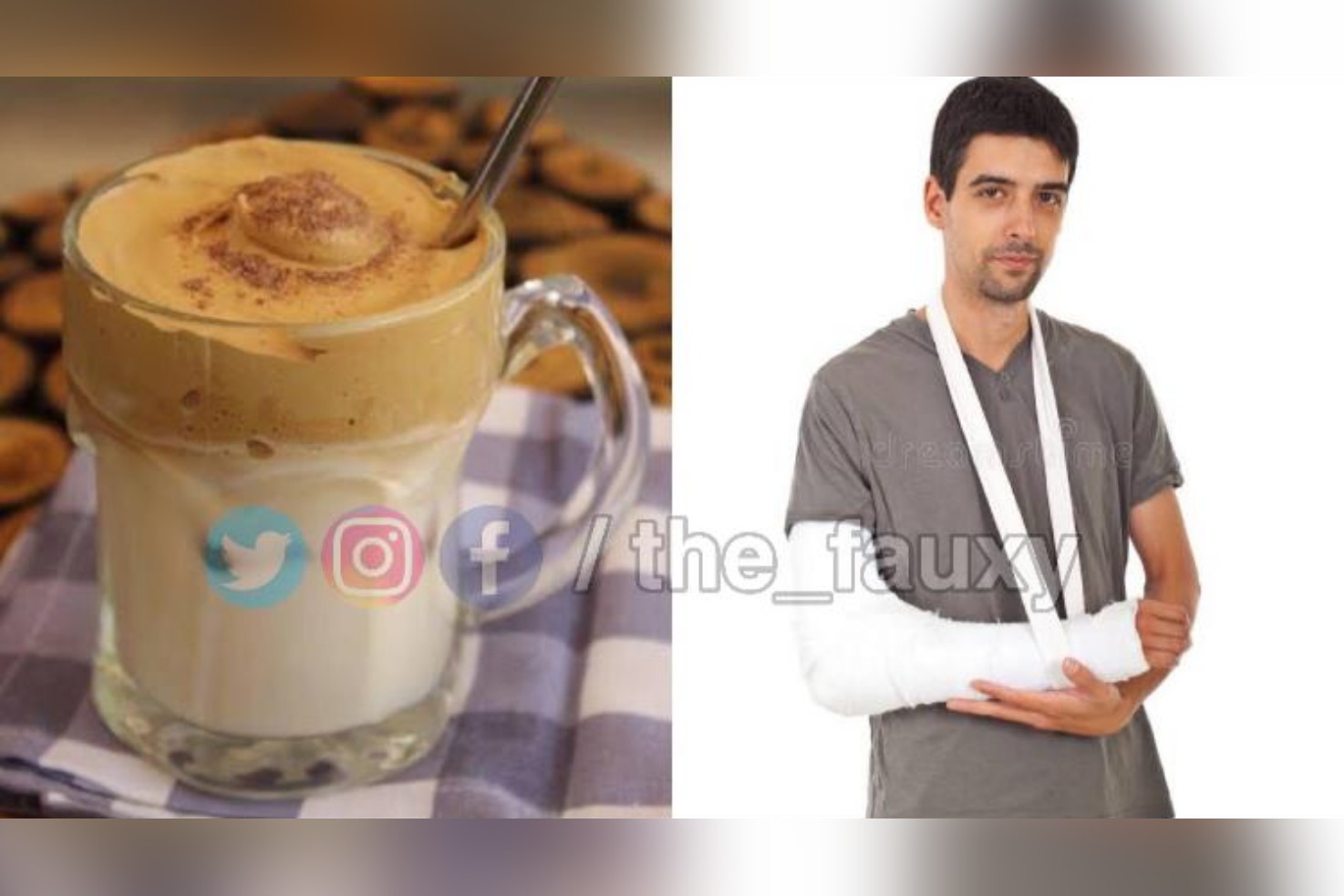 Food blogger loses his arm while beating coffee to participate in Dalgona Coffee Trend