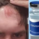 After No Side Effect Of Covaxin, Liberal Bangs His Head On A Wall To Have Dizziness Reveals CCTV Footage