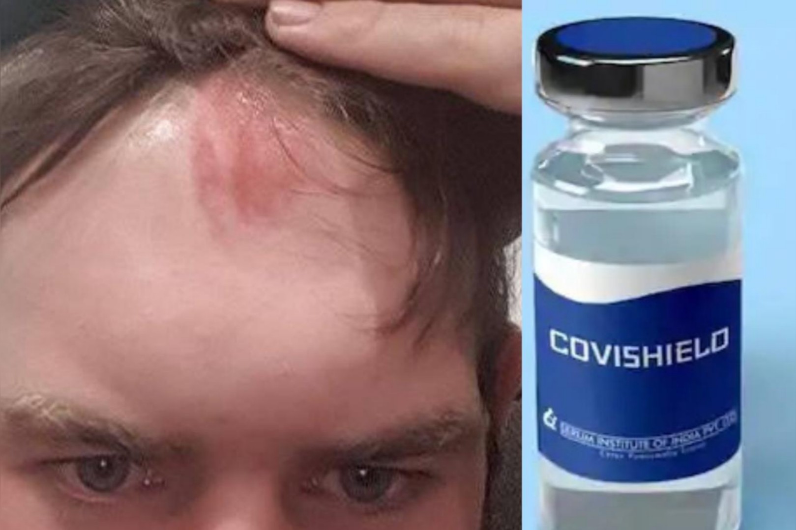 After No Side Effect Of Covaxin, Liberal Bangs His Head On A Wall To Have Dizziness Reveals CCTV Footage