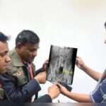 Kerala Man Caught Smuggling Petrol In His Rectum